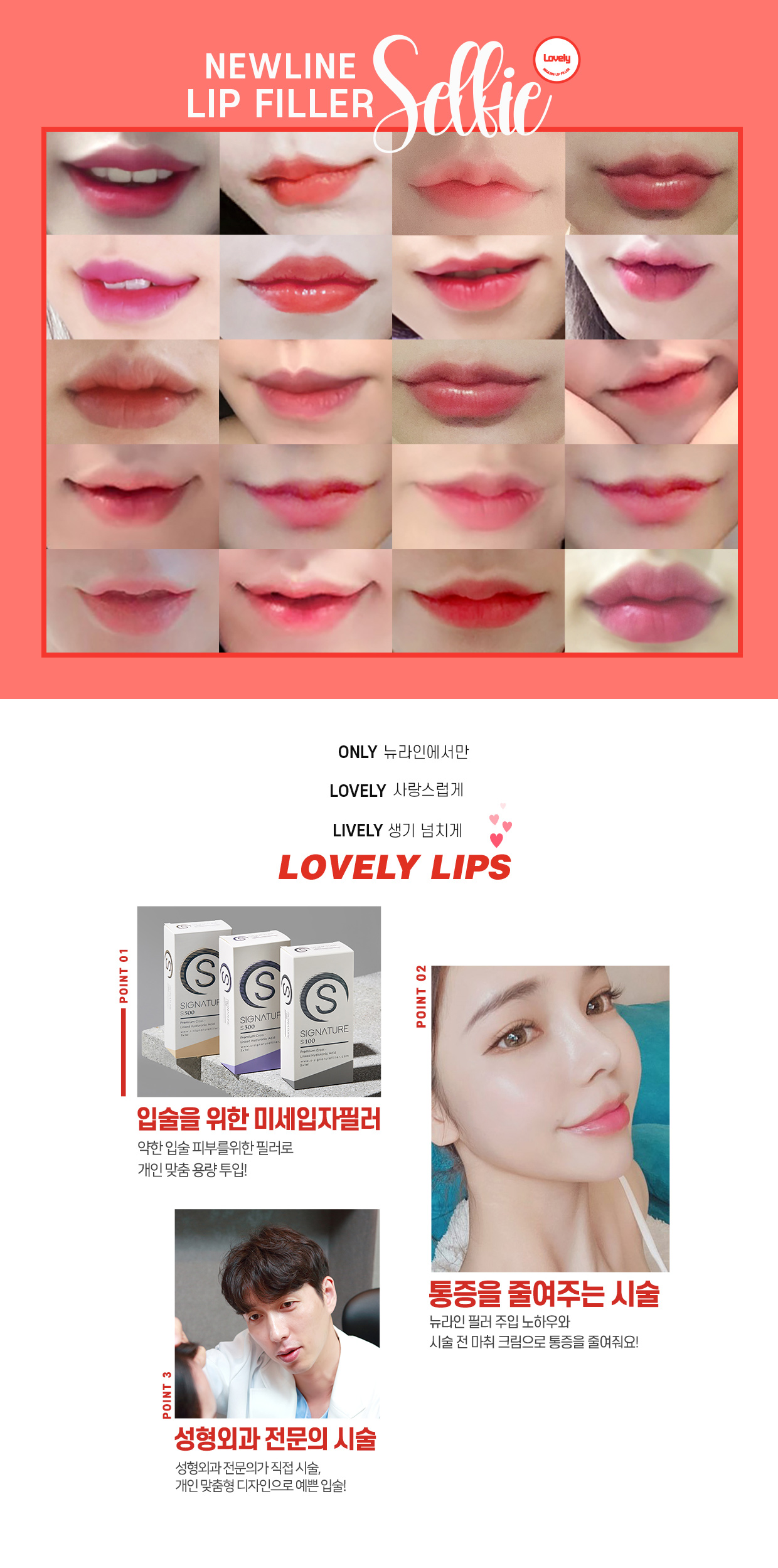 입꼬리필러