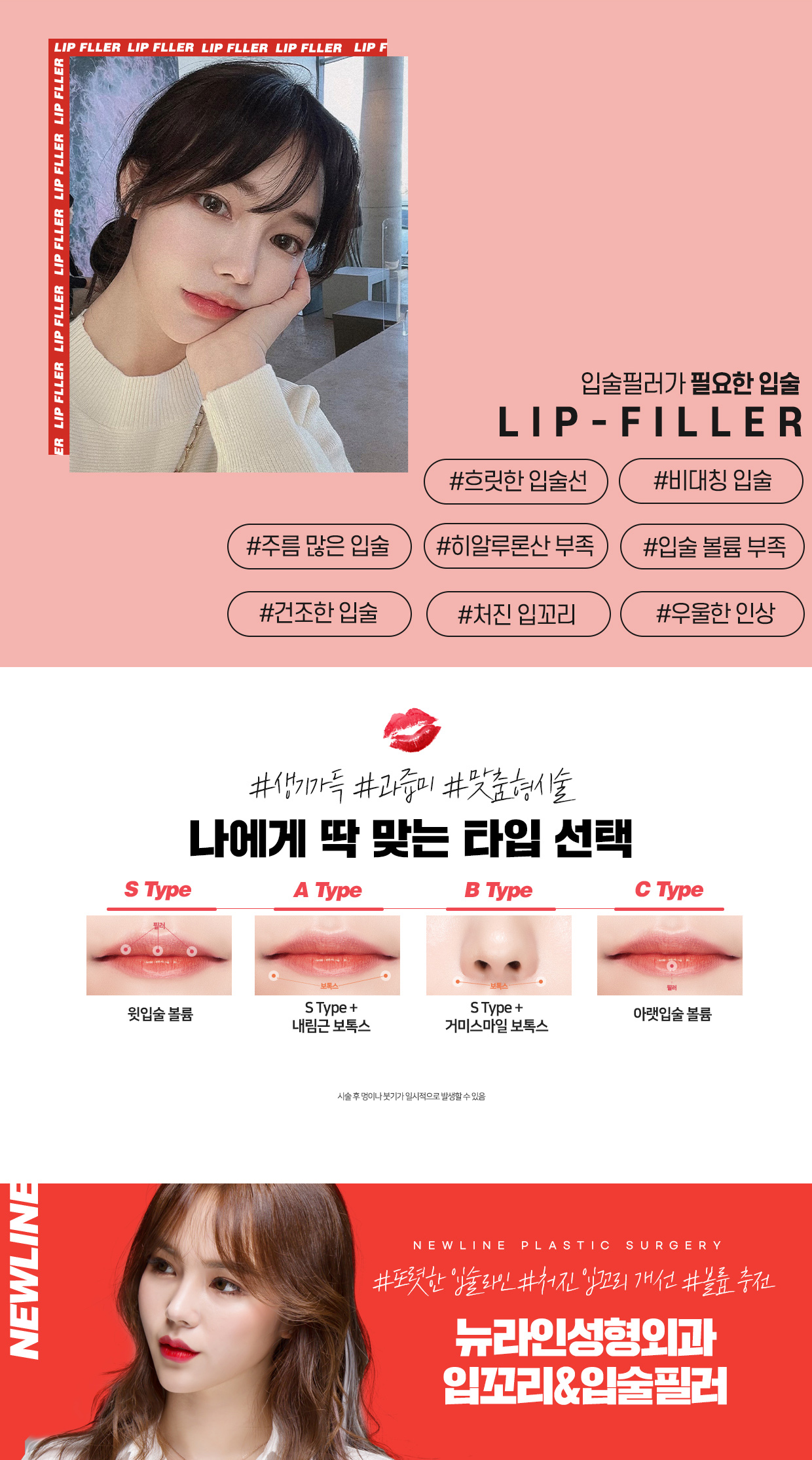 입꼬리필러