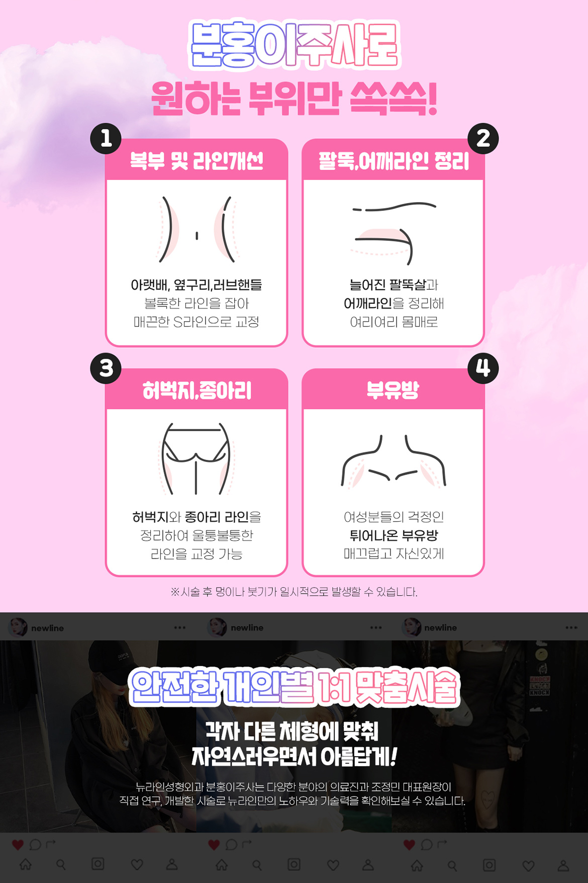 분홍이주사