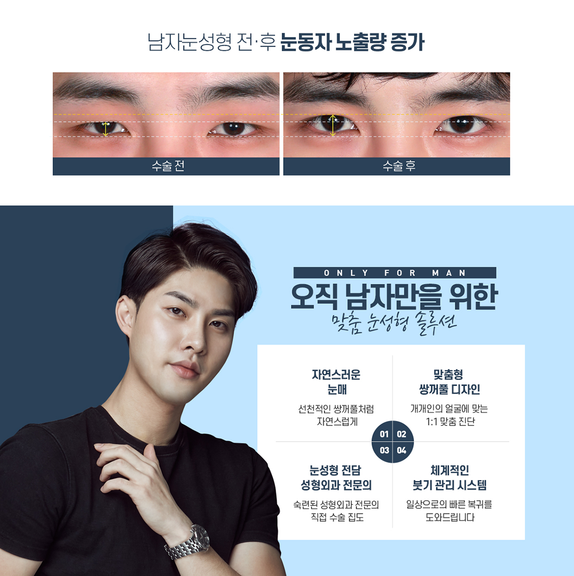 뉴라인 남자눈성형