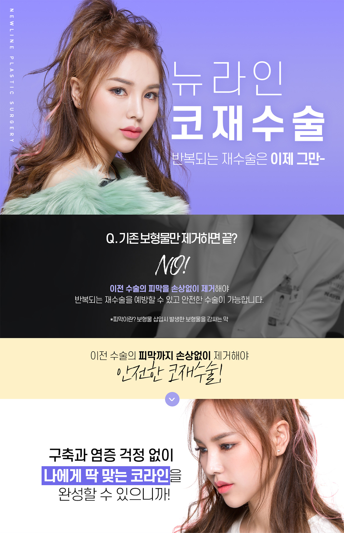 뉴라인 코재수술