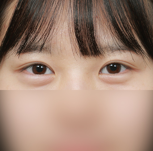 /upload/1669861346eZe6TMy11S.jpg