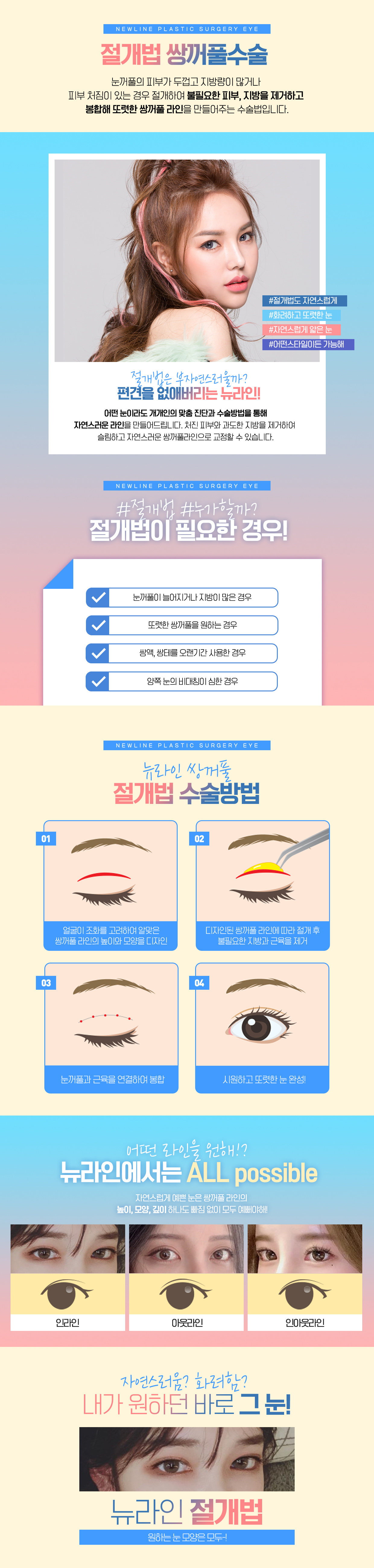 절개법