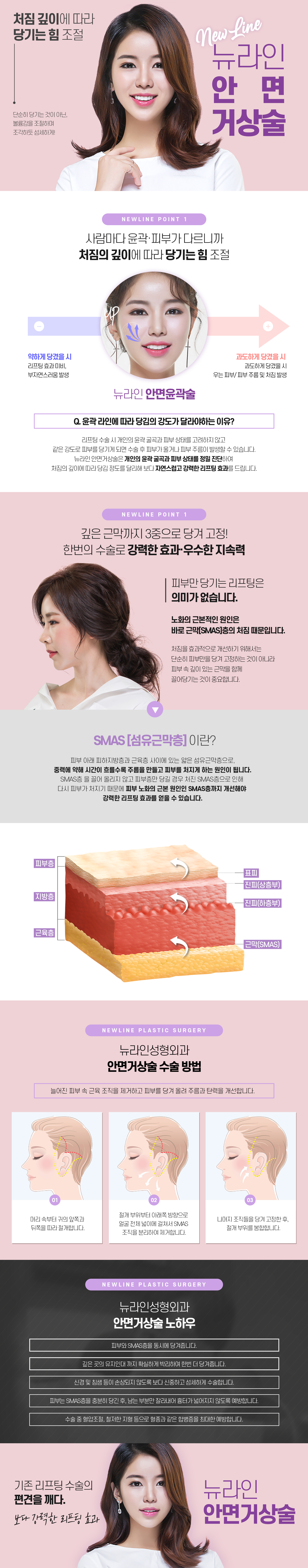 안면윤곽술