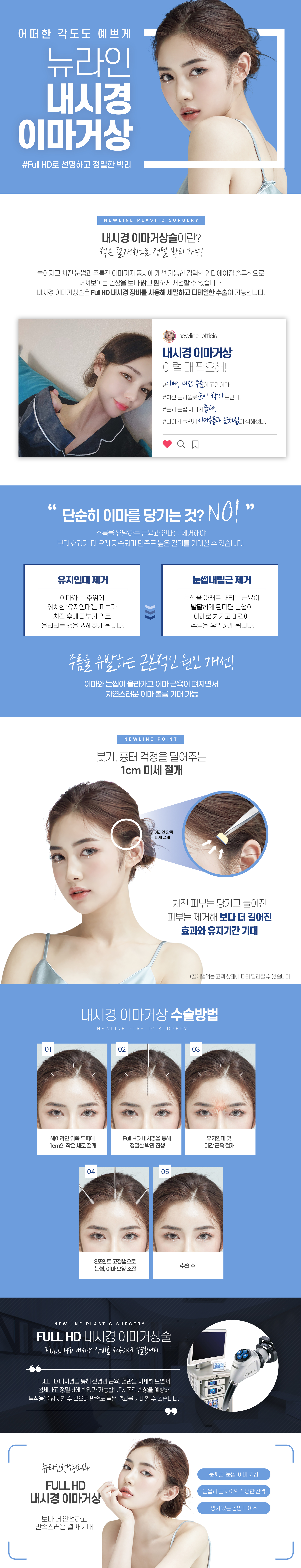 내시경 이마거상