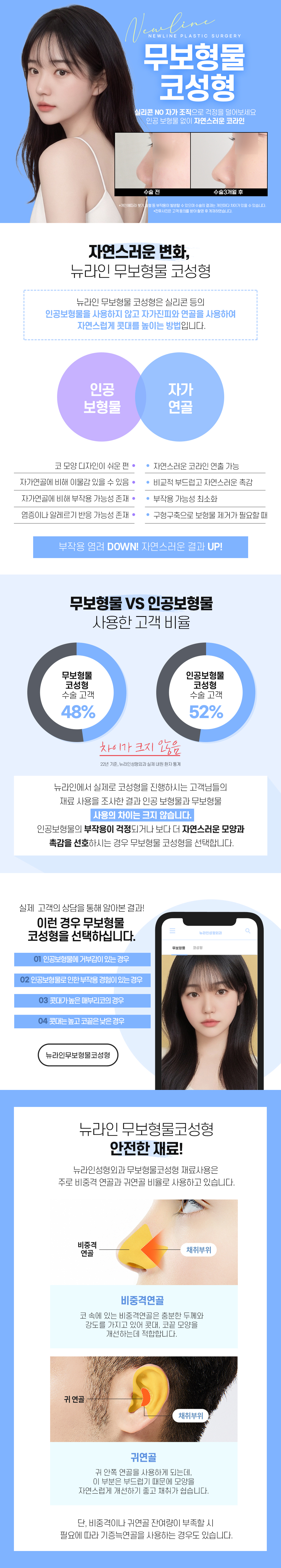 무보형물 코성형