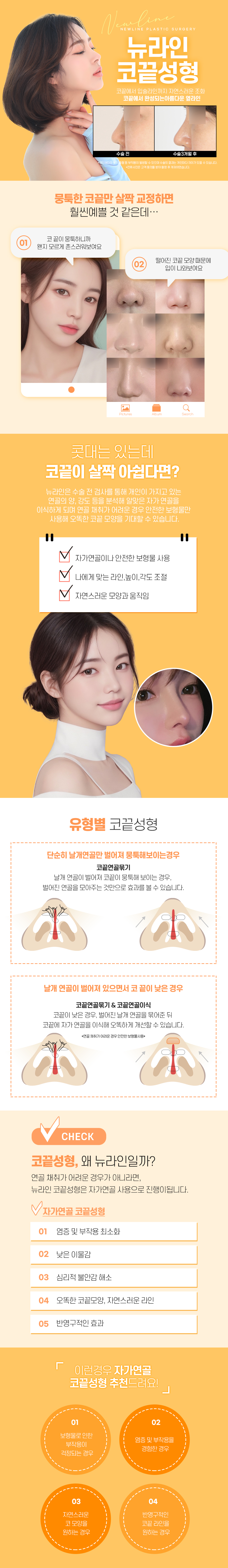 코끝성형